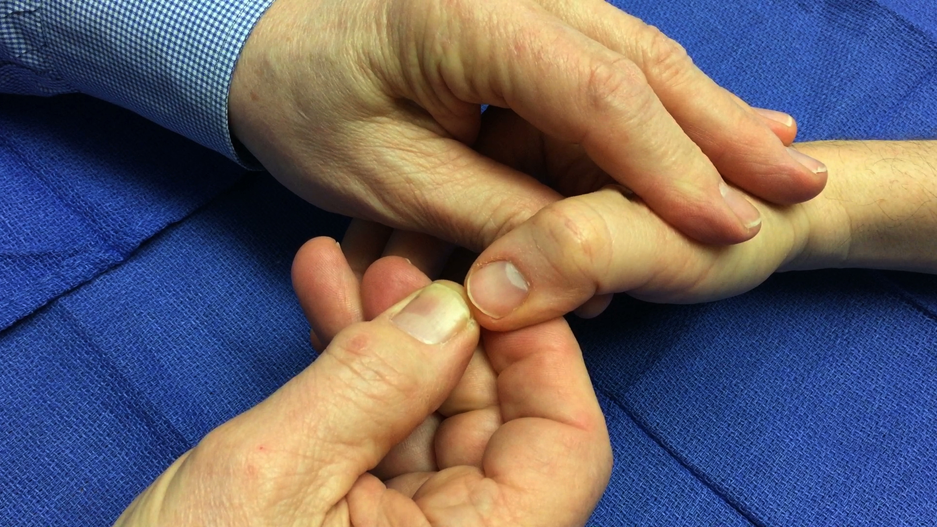 Capillary Refill Hand Surgery Resource